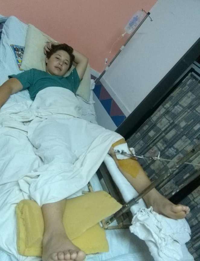 Un chico que se accidentó espera una prótesis y su familia necesita ayuda