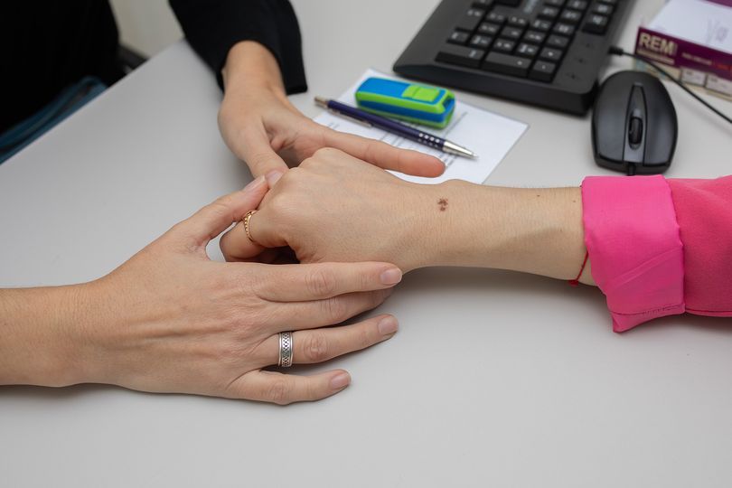 Controles y protección solar, las claves para evitar el cáncer de piel